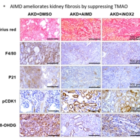 Antibiotic-induced intestinal microbiota depletion can attenuate the acute kidney injury to chronic kidney disease transition via NADPH oxidase 2 and trimethylamine-N-oxide inhibition